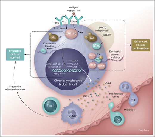 Role of ZAP70 in promoting increased malignant cell fitness in chronic lymphocytic leukemia. Weak tonic signals from the B-cell receptor (BCR), generated by an unclear mechanism, influence ZAP70 to stimulate constitutive activation of AKT, some protein translation, and enhanced transcription of the genes coding for CCL3, CCL4, IL4I1, and MYC. Released CCL3 and CCL4 can stimulate migration of monocytes and T cells into proliferation centers (the former becoming macrophages that serve as nurse-like cells), and these cells provide a supportive microenvironment. In this context, ZAP70 serves to enhance malignant cell survival in CLL. If BCR comes into contact with antigen, strong signals ensue that stimulate association of ZAP70 with ribosomal proteins (such as RPS-17), where the kinase function of ZAP70 may play a role and enhance protein translation. At the same time, the BCR signaling pathway is activated where AKT shows strong activation, leading to increased expression of MYC, but this response is independent of ZAP70. Nevertheless, the outcome of such strong signaling from the BCR is enhanced cellular proliferation. Increased fitness of CLL cells expressing ZAP70 in terms of survival and proliferation are therefore likely to contribute to progressive disease, explaining why expression of this tyrosine kinase is linked with poor prognosis. mTOR, mammalian target of rapamycin; P, phosphate. Professional illustration by Somersault18:24.