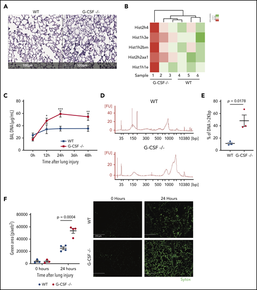 Neutropenic mice have more DNA-containing debris following acid injury of the lung. (A) Lungs from injured areas of WT and G-CSF−/− lungs were fixed 24 hours after unilateral acid-induced lung injury and stained with hematoxylin-and-eosin sections. Scale bar, 100 μm. The extent of debris is apparent. (B) BAL fluid sampled 24 hours after acid-induced lung injury from neutropenic (G-CSF−/−) mice and WT mice were compared using mass spectroscopy after depleting albumin and IgG. We appreciated a marked increase in nuclear-associated proteins in the neutropenic mice relative to WT mice. (C) Measurements of BAL nucleic acid concentration at baseline (0 hours), 12 hours, 24 hours, and 48 hours after inducing lung injury show a persistent increase in BAL DNA concentration with a peak occurring 24 hours after injury. (D) Agarose gel electrophoresis of BAL-derived DNA from WT and G-CSF−/− mice 24 hours after injury. (E) Quantification of the distribution of DNA sizes in BAL in the 2 genotypes. (F) Sytox staining of lung through the intratracheal route before fixation. Little Sytox staining is detected in uninjured lungs. Twenty-four hours after injury, however, Sytox staining appears more intense in G-CSF−/− mouse lungs than WT. Scale bar, 250 μm. Each point on the graphs represents 1 animal. The error bars represent the standard error of mean. *P < .05; **P < .01; ***P < .001.