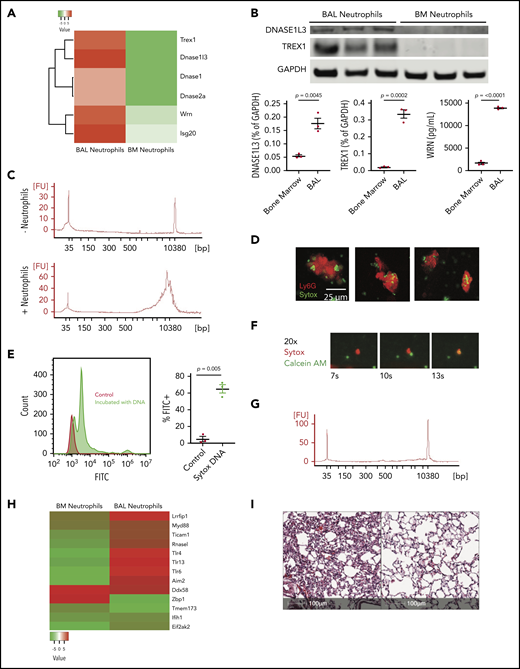 Neutrophils ingest and degrade DNA. (A) Heat map of proteins with DNase activity in neutrophils from BM or BAL. (B) Western blot (TREX1 and DNASE3L1) and ELISA (WRN) analysis of BAL neutrophils compared with BM neutrophils assessing differential protein expression. (C) Bioanalyzer tracings of supernatant after incubation of salmon sperm nuclei either without (top) or with (bottom) BAL neutrophils. The sharp spikes in the tracing without neutrophils represent standards. (D) Ingestion of nuclei by neutrophils. Neutrophils were incubated with Sytox-labeled salmon sperm DNA for 1 hour and neutrophils were stained with anti-Ly6g. Scale bar, 25 μm. Images of neutrophils having taken up DNA are shown. (E) Neutrophils from injured lungs exposed to Sytox through the intratracheal route were recovered by BAL, and stained with anti-Ly6g compared with WT neutrophils. (F) Frames (original magnification ×20) from supplemental Video 1 showing neutrophil engulfment of DNA debris in real time. (G) MyD88−/− neutrophils were impaired in their ability to degrade DNA as assessed by agarose gel. (H) Heatmap of nucleic acid–sensing pattern-recognition receptors in BAL-derived neutrophils compared with BM-derived neutrophils after acid instillation. (I) Histologic section 96 hours after acid injury in a G-CSF−/− mouse, which shows that repair is impaired (left). G-CSF−/− mice were given recombinant Dornase-α (50 μg) via the intranasal route 24 and 48 hours after injury and the degree of repair is markedly improved (right). Scale bar, 100 μm; hematoxylin and eosin stain. Each point on the graphs represents 1 animal. The error bars represent the standard error of mean.
