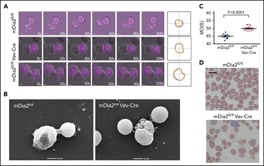 mDia2 is essential for the mobility of R1 reticulocytes. (A) Time lapse real-time microscopy of enucleating erythroid cells derived from cultured bone marrow erythroblasts obtained from the indicated mice. Still frames of cells at the indicated times (seconds) are shown. The bottom panels show an enucleating cell with 2 extruding nuclei. Nuclei were stained with NucRed Live 647. Bars represent 1 μm. White dots outline R1 reticulocytes. Far right panels show the overlapped outlines of the dynamic reticulocytes at different time points. (B) Scanning electron microscopy analyses of enucleating cells from panel A. (C) Mean corpuscular volume of RBCs from peripheral blood of the indicated mice at 1 month of age. (D) Wright-Giemsa–stained peripheral blood smears from the indicated mice at 1 month of age. Bar represents 10 μm.
