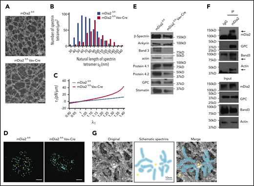 Loss of mDia2 compromises erythrocyte membrane skeleton structure. (A) TEM study of the membrane skeleton of ghost erythrocytes from the indicated mice. Data are representative of 13 randomly selected fields. (B) The length distributions of the spectrin tetramers with corresponding frequencies in ghost erythrocytes calculated based on the TEM images in panel A. (C) Computationally predicted stress of the membrane skeleton under uniaxial tension with the increased deformation (λ1) of the indicated mice. A shear modulus μ0=13.1pN/μm is estimated for mDia2fl/fl cells and μ0=26.5pN/μm for mDia2fl/flVav-Cre cells. (D) STORM imaging analyses of actin protofilaments in ghost erythrocytes from the indicated mice. Bars represent 1 μm. (E) Western blot analyses of the indicated erythroid membrane skeleton proteins of ghost erythrocytes from the indicated mice. An equal number of cells was used. (F) Immunoprecipitation assay using IgG or mDia2 antibodies in normal human ghost erythrocytes. Western blot analyses were performed to determine the coprecipitated proteins. (G) Immunogold stain of mDia2 and electron microscopy analysis of normal human ghost erythrocytes. Yellow dots and blue stripes in the schematic spectrin graph indicate gold particles and spectrin bands, respectively.