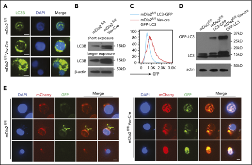 Defects of autophagosome-lysosome fusion in mDia2-deficient erythroid cells. (A) Lineage-negative cells from the bone marrow of the indicated mice were cultured in erythropoietin-containing medium for 2 days. Representative images of LC3B-stained orthochromatic erythroblasts are shown. Bars represent 2 μm. Images are representative of 10 randomly selected fields. The bottom panels illustrate a binucleated orthochromatic erythroblast. (B) Western blot analysis of the cells in panel A. (C) Lineage-negative cells from the bone marrow of the indicated mice were cultured in erythropoietin-containing medium for 2 days. Flow cytometric analysis was performed to determine GFP intensity on the Ter119+ DNA+ erythroblasts. (D) Western blot analysis of the cells in panel C for the detection of GFP-LC3 and LC3. (E) Lineage-negative cells from the indicated mice were transduced with Lenti-mCherry-EGFP-LC3. The cells were cultured in erythropoietin-containing medium for 2 days. Representative images of erythroblasts at different developmental stages based on the nuclear size were presented. Bars represent 10 μm. Images are representative of 10 randomly selected fields.