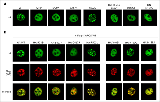 Pericentromeric targeting of the mutant IKAROS. NIH3T3 cells were transfected with a hemagglutinin (HA)-tagged WT or mutant expression vector alone (A) or together (B) with Flag-tagged WT IKAROS. Cells were labeled with anti-HA or together with anti-Flag antibodies, followed by Alexa Fluor 488–conjugated (green) and Alexa Fluor 568–conjugated (red) secondary antibodies. Cells were visualized using a ZOE fluorescence microscope (original magnification, ×175). Data are representative of 3 independent experiments. HI and DN indicate DNA binding–defective haploinsufficient mutation and DN mutation, respectively. Scale bars, 25 μm.