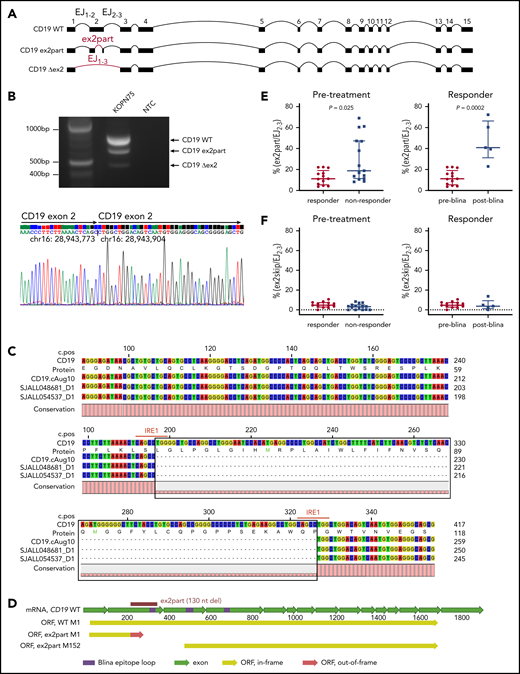 Identification of an alternative CD19 splicing isoform (ex2part) associated with blinatumomab response. (A) Visualization of 3 CD19 isoforms: wild type (WT), ex2part, and ex2skip (Δex2). (B) Reverse transcription polymerase chain reaction of CD19 in KOPN75 cells showing 3 bands corresponding to CD19 WT, ex2part, and ex2skip (top). Sanger sequencing of CD19 ex2part in KOPN75 cells, confirming deletion of 130 nucleotides in exon 2 (bottom). (C) Consensus sequence assembled from Nanopore long-read RNA-seq identified the AceView isoform CD19 cAug10 with ex2part in 2 B-ALL patients. Numbers on top indicate coding sequence position; numbers on the right indicate RNA/protein position. IRE1-mediated splicing sequence CAGCCTGG indicated in red. (D) Full-length structure of CD19 WT and ex2part. Frame-shift partial deletion of exon 2 coding for amino acids Leu66 to Pro109 (ex2part) leads to a new start codon at Met152 of the canonical CD19. Translation of ex2part from the canonical start M1 results in a premature stop codon. (E) Levels of ex2part (E) and ex2skip (F) in pretreatment samples comparing responders (n = 13) and nonresponders (n = 15; left) and preblinatumomab (n = 13) compared with postblinatumomab relapse (n = 5; right). Median and interquartile range are displayed. P value determined using Mann-Whitney test. mRNA, messenger RNA; ORF, open reading frame.