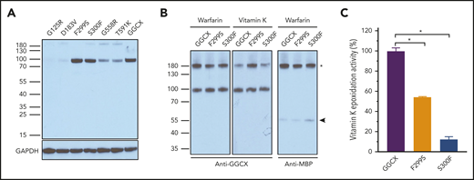 Characterization of GGCX mutations that dramatically decreased carboxylation activity. (A) Western blot analysis of the expression of GGCX mutations in HEK293 cells. Wild-type GGCX and GGCX mutants that significantly decreased reporter protein carboxylation were transiently expressed in GGCX-deficient HEK293 cells for 48 hours. Whole-cell lysate was used for Western blot analysis using a rabbit anti-GGCX polyclonal antibody as the primary antibody. Glyceraldehyde 3-phosphate dehydrogenase (GAPDH) was used as the sample loading control. (B) Interaction of GGCX with its protein substrate in live cells probed by DSS cross-linking. Wild-type GGCX, the F299S mutant, or the S300F mutant was transiently coexpressed with FIXgla-MBP fusion in GGCX-deficient HEK293 cells. Forty-eight hours later, transfected cells were cross-linked with DSS at a final concentration of 4 mM for 30 minutes. Whole-cell lysate was used for Western blot analysis using a rabbit anti-GGCX or an anti-MBP polyclonal antibody as the primary antibody. The GGCX and FIXgla-MBP cross-linked band was marked with an asterisk. The FIXgla-MBP monomer is marked with an arrowhead. (C) Effect of GGCX mutations on vitamin K epoxidase activity. Wild-type GGCX, the F299S mutant, or the S300F mutant was transiently expressed in GGCX-deficient HEK293 cells. Transfected cells were incubated with vitamin K and the epoxidation of vitamin K to vitamin K epoxide by GGCX was determined by a conventional reversed-phase high-performance liquid chromatography assay. Data are presented as the mean ± SD of 3 independent experiments (n = 3). *P < .001.