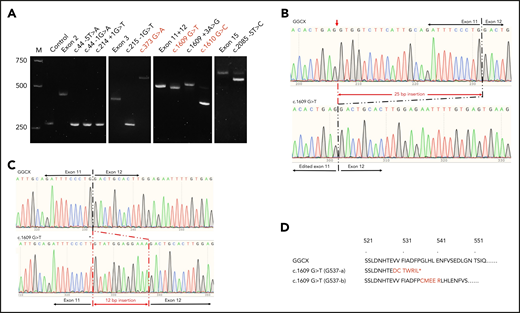 Effect of GGCX mutations on its pre-mRNA splicing. (A) Minigene splicing assay of GGCX mutations. GGCX mutations and the wild-type sequences of the affected exons were transiently transcribed in HEK293 cells. The splicing products were amplified by reverse transcriptase-PCR and visualized by 2.5% agarose gel electrophoresis. Previously reported missense mutations in GGCX’s coding regions were labeled in red. M, DNA ladder marker; Control, splicing product from the empty vector. Exon 2, exon 3, exon 11+12, and exon 15 are the splicing products from the wild-type GGCX sequence of the corresponding exons. (B) Sequencing results of the splicing products of wild-type GGCX and of the c.1609 G>T mutant (bottom band). The mis-splicing site in exon 11 is indicated with a red arrowhead. (C) Sequencing results of the splicing products of wild-type GGCX and the c.1609 G>T mutant (top band). The 12-bp intronic insertion sequences are indicated in red. The c.1609 G>T mutation in the mis-splicing sequence is indicated with an asterisk. (D) Amino acid sequences of the 2 mis-splicing products of the c.1609 G>T mutation. The G537-a sequence corresponds to the mis-splicing of the 25-bp deletion, as shown in panel B. The G537-b sequence corresponds to the mis-splicing of the 12-bp insertion, as shown in panel C. Additional sequences introduced to GGCX are highlighted in red. The asterisk in the G537-a sequence indicates an introduced stop codon because of the frame-shift translation.