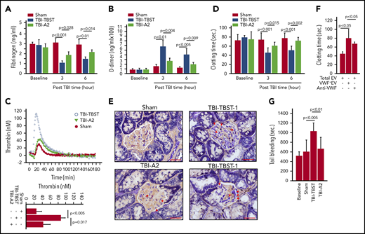 A2 reduced TBI-induced hypercoagulable and hyperfibrinolytic states. (A,B) Fibrinogen (A) and D-dimer (B) were measured in plasma from sham and TBI mice receiving either A2 or buffer control. (C) Thrombin generation was induced in plasma collected 3 hours after TBI (top: representative traces; bottom: summary of 9 experiments). (D) The time to coagulate anionic phospholipid-depleted plasma by EVs from sham mice and TBI mice receiving A2 or TBST (A-D, n = 9-15; 1-way ANOVA). (E) The PTAH stain of kidney tissue sections shows extensive fibrin deposition in the glomerular microvasculature (TBI-TBST-1, red arrows; scale bars, 100 μm) and in perivascular interstitial tissue (TBI-TBST-2, red arrows) from mice subjected to TBI, but not from sham mice (sham). The PTAH stain is less extensive in TBI mice receiving A2 (TBI-A2, red arrows). Images are representative of 12 mice/group. (F) EVs from TBI were tested for inducing clot formation before and after VWF+EVs were depleted; the number of remaining VWF− EVs was adjusted to the predepletion level, or a VWF-blocking antibody was added (n = 12, 1-way ANOVA on ranks). (G) The tail bleeding time of sham and TBI mice receiving A2 or TBST, measured 3 hours after injury (n = 21, 1-way ANOVA).