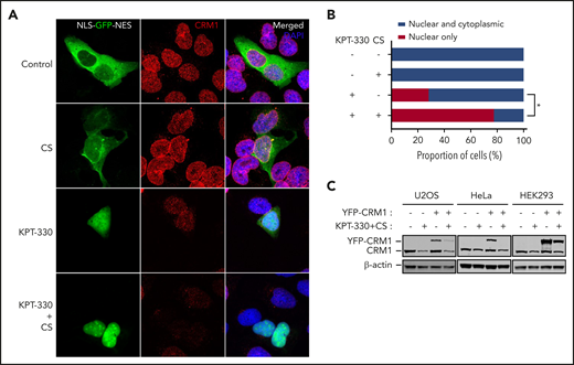 KPT-330+CS is a better inhibitor of nuclear export and decreases CRM1 expression. (A) Immunofluorescence microscopy images obtained from Zeiss LSM 780 confocal microscope at original magnification ×60 showing the subcellular localization of GFP (green) and endogenous CRM1 (red) in U2OS cells transfected with nuclear export reporter construct (NLS-GFP-NES), and treated with the indicated conditions for 24 hours. (B) Quantitation of nuclear export efficiency. GFP-transfected U2OS cells were evaluated and scored for percentage with complete nuclear localization of GFP signal. (C) Immunoblot images showing the expression of transfected CRM1-YFP and endogenous CRM1 in U2OS, HeLa, and HEK293 cells treated with the indicated conditions for 24 hours. *P = .02. The paired Student t test was used to compare all continuous variables. A value of P < .05 was considered statistically significant.