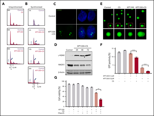 KPT-330+CS arrests cells in S phase and inhibits DNA damage repair. (A) Cell-cycle profile of CS, KPT-330, and KPT-330+CS–treated unsynchronized JeKo-1 cells. The KPT-330+CS treatment arrests cells at S phase (blue filled arrow) and induces cell death (blue hollow arrow). (B) Cell-cycle profiles of KPT-330+CS–treated JeKo-1 cells assessed at different time points from release after G1-phase synchronization. Blue filled arrow indicates progression of S-phase arrest with time and blue hollow arrow indicates fraction of cell death. (C) γ-H2AX foci (green) formed in JeKo-1 cells following KPT-330+CS treatment of 24 hours. Images were obtained from a Zeiss LSM 780 confocal microscope at ×100 magnification (D) Immunoblot assessing γ-H2AX and Rad51 in JeKo-1 cells following KPT-330+CS treatment. (E) Comet assay indicated DNA damage (comet tail) in JeKo-1 cells treated with KPT-330+CS for 24 hours. Images were obtained from Zeiss LSM 780 confocal microscope at ×10 magnification after staining with SYBR gold DNA stain (red square denotes cells additionally magnified 2×). (F) HRD assessment following respective drug treatments. Y-axis represents percent GFP+ cells assessed through flow cytometry. The GFP+ cell signifies the degree of HR proficiency. (G)Viability assessment of JeKo-1 cells through Annexin V/PI assay following 48 hours of incubation with respective drug concentrations; KPT-330 (0.5 µM), and CS (3 mM) and olaparib (10 µM). **P = .0016. The paired Student t test was used to compare all continuous variables. A value of P < .05 was considered statistically significant.