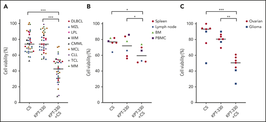 KPT-330+CS imposes significant antitumor effect on primary malignant patient samples. (A) Viability assay on mononuclear cells obtained from primary patient tissue samples with malignancy following 48 hours of incubation with respective drug treatment. Plasma cells from patients with MM were obtained following CD138 sorting through positive selection. (B) Viability assay showing the effect of KPT-330, CS and KPT-330+CS on mononuclear cells obtained from peripheral blood of healthy donors without a flow cytometry proven diagnosis of malignancy, and tissue biopsies from the indicated tissue types from patients without a diagnosis of cancer per histopathologic review. Cells were treated with 0.5 µM KPT-330 and 3 mM CS as single agent or in combination for 48 hours. (C) Patient tumor samples derived from PDX (5 ovarian cancers and 2 gliomas) were treated ex vivo with KPT-330 and CS as single agents, or in combination. Ovarian tumor cells were treated with 0.6 µM KPT-330 and 0.6 mM CS as single agent or in combination. Glioma cells were treated with 0.1 µM KPT-330 and 0.3 mM CS as single agent or in combination. *P < .05 to P < .005; **P < .005 to P < .0005; ***P < .0005. Paired Student t test was used to compare all continuous variables. A P value of <.05 was considered statistically significant.BM, bone marrow; CLL, chronic lymphocytic leukemia; CMML, chronic myelomonocytic leukemia; LPL, lymphoplasmacytic lymphoma with IgG monoclonal gammopathy; MCL, mantle cell lymphoma; MZL, marginal zone lymphoma; PBMC, peripheral blood mononuclear cell; PDX, patient-derived xenograft; TCL, T-cell lymphoma; WM, Waldenstrom macroglobulinemia.