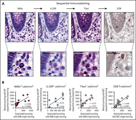 Sequential immunostaining of GI biopsies. (A) Representative example of a GI biopsy stained sequentially for RARα, IL-23R, and T-bet using VIP chromogen and hematoxylin counterstain; positive cells stained purple, and CD8 stained brown (using DAB chromogen). Subcrypt regions are indicated by a white outline. Cells with high and low or no expression of individual markers are indicated with red and black arrows, respectively. Scale bars, 25 µm. (B) Sequential immunostaining was validated by demonstrating a close correlation between mononuclear cell numbers in sequentially stained sections enumerated using manual counting. Mononuclear cell numbers in the same sections were stained by using conventional single-stain IHC and enumerated by using automated cell counting with the Ariol system. P and r values are for Pearson correlation coefficients.