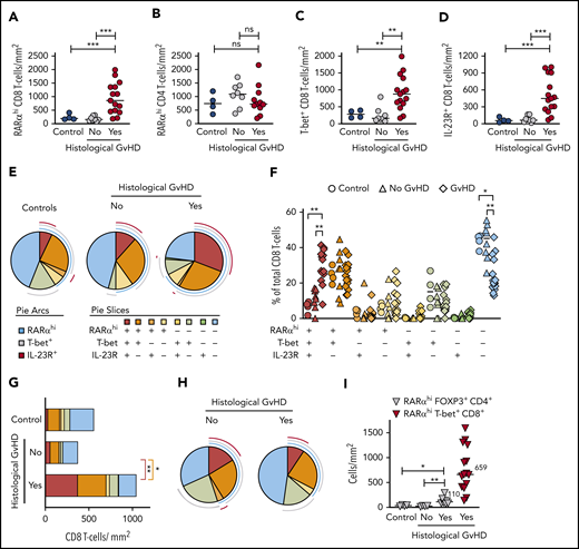 Sequential immunostaining reveals an increase in tissue-specific RARαhi CD8 effector T cells coexpressing T-bet and IL-23R in GI-GVHD. (A) RARαhi CD8 and (B) CD4 T-cell numbers in subcrypt regions of upper and lower GI biopsies from allo-HSCT patients with and without histologic GVHD and lower GI biopsies from healthy controls. (C) CD8 T-cell numbers co-expressing T-bet or (D) IL-23R in subcrypt regions of upper and lower GI biopsies from allo-HSCT patients with and without histologic GVHD and lower GI biopsies from healthy controls. (E) SPICE plots depicting subpopulations of CD8 T cells in subcrypt regions of GI biopsies. Arcs represent median frequencies of CD8 T cells expressing high RARα, T-bet, or IL-23R. Slices represent median frequencies of CD8 T-cell subpopulations by coexpression patterns of RARα, T-bet, and IL-23R. Results are shown for upper and lower GI biopsies from 4 healthy controls and 22 allo-HSCT patients, 15 with and 7 without histologic GVHD. (F) CD8 T-cell subpopulations expressed as a percentage of total CD8 cells in subcrypt regions of upper and lower GI biopsies from 4 healthy controls (circles) and 22 allo-HSCT patients, 15 with (diamonds) and 8 without (triangles) histologic GVHD. (G) Absolute numbers of CD8 T-cell subpopulations in subcrypt regions of GI biopsies. Color key is as shown in panel E. (H) SPICE plots depicting frequencies of subpopulations of CD8 T cells in epidermis of skin biopsies from allo-HSCT patients. Pie arcs and slices are designated as in panel E. Results are shown for biopsies from 11 allo-HSCT patients, 8 with and 3 without histologic skin GVHD. (I) Absolute numbers of RARαhi CD4 T cells coexpressing FOXP3 in subcrypt regions of GI biopsies from 12 allo-HSCT patients and 4 healthy controls. Numbers of RARαhi T-bet+ CD8 effector T cells in GI biopsies from allo-HSCT patients with histologic GVHD are shown for comparison. Horizontal lines and adjacent numbers are medians. *P < .05; **P < .01; ***P < .001, analysis of variance (ANOVA) tests with posttest correction for multiple comparisons.