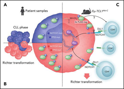 Modeling the role of AKT in RT. (A) CLLs with high-risk features show constitutive activation of AKT (pAKT). (B) More than one-half of RTs show constitutive activation of AKT. (C) Genetic constitutive activation of AKT in the TCL1 mouse model leads to expansion of microenvironment CD4 cells expressing the NOTCH ligand DLL1, leading to activation of NOTCH1, which drives transformation.