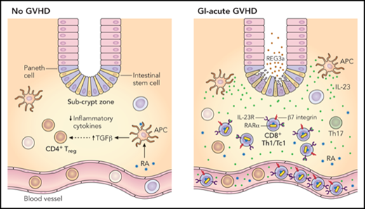 In the normal steady state, RA is involved in the secretion of transforming growth factor β (TGF-β) from antigen-presenting cells (APCs) and promotion of a CD4+ Treg phenotype as well as an overall reduced expression of proinflammatory cytokines. In the setting of GI-aGVHD, infiltration of triple-positive CD8+ T-effector (Teff) cells enriched for Tbet (Th1/Tc1 lineage), RARα, and IL-23R occurs in the intestinal subcrypt zone adjacent to intestinal epithelial stem cells. CD4+ Tregs are also expanded in the subcrypt zone in the setting of GI-aGVHD but to a much lesser extent. Both lineages likely derive from the peripheral blood in response to RA, where (modulated by IL-23/LPS in the setting of GI-aGVHD) expression of GI-trophic receptors (eg, β7 integrin) is induced preferentially on CD8+ Teff cells (vs CD4+ Tregs). Professional illustration by Patrick Lane, ScEYEnce Studios.
