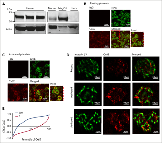 Expression and localization of Cx62 in platelets. (A) The presence of Cx62 was examined by immunoblot analysis of whole-cell lysates from human and mouse whole platelets, MegO1, and HeLa cells using a rabbit polyclonal anti-GJA10 antibody. Actin was used as a loading control. (B-C) The localization of Cx62 in resting and activated (with 5 μM U46619 in the presence of 3 μg/mL integrelin) permeabilized human platelets (0.2% Triton-X-100) was investigated using immunofluorescence microscopy. Cx62 (in red) and membrane GPIb receptors (in green) were stained using anti-GJA10 and anti-GPIb primary antibodies, respectively. Visualization was performed using Alexa-647– and Alexa-488–conjugated secondary antibodies, respectively. (D) The distribution of Cx62 was also studied using super-resolution stochastic optical reconstruction microscopy. Resting and activated permeabilized human platelets were stained using anti-GJA10 and anti-integrin β3 primary antibodies and visualized using Alexa-647– and Alexa-555–conjugated secondary antibodies, respectively. (E) CBC analysis was performed to determine the levels of Cx62 and β3 integrin colocalization in resting (0, red line) platelets and after stimulation with thrombin (1 U/mL) for 5 minutes (300, blue line). A CBC value of 0 represents a random distribution, and a positive value indicates closer distribution than expected at random. Data are representative of ≥3 separate experiments.