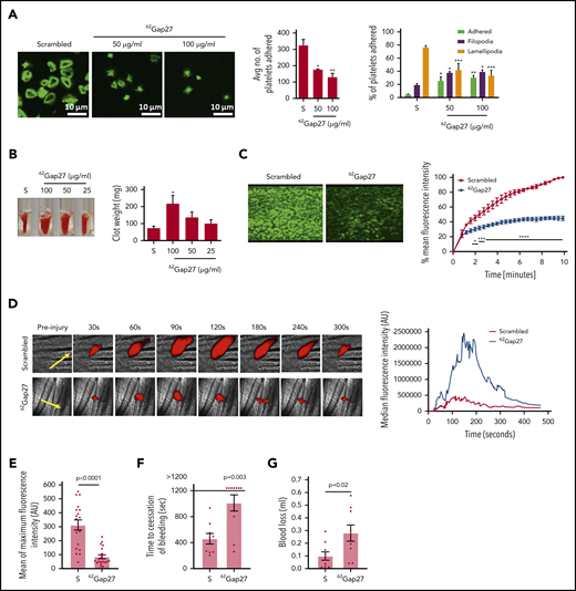 62Gap27 inhibits integrin αIIbβ3-mediated signaling, thrombosis, and hemostasis. (A) Human washed platelets (2 × 107 cells/mL) incubated for 5 minutes with 62Gap27 (50 and 100 μg/mL) or scrambled peptide (S; 100 μg/mL) were exposed to fibrinogen-coated (100 μg/mL) coverslips. Representative images of spreading and adhesion of platelets after 45 minutes and cumulative data for platelets adhered to fibrinogen in each sample are shown. Spreading platelets were categorized into 3 groups (adhered but not spread; filopodia, platelets in the process of extending filopodia; and lamellipodia, fully spread). (B) To measure clot retraction, human PRP was incubated with 62Gap27 (50 and 100 μg/mL) or scrambled peptide (S; 100 μg/mL) for 5 minutes before clot formation was initiated by the addition of thrombin (1 U/mL). The extent of clot retraction was determined by comparing clot weight after 60 minutes. (C) 3,3′-Dihexyloxacarbocyanine iodide (DiOC6)-loaded human whole blood was treated with scrambled peptide or 62Gap27 (100 μg/mL) for 5 minutes before perfusion through collagen-coated (100 μg/mL) Vena8Biochips at an arterial shear rate of 500 s−1 (20 dyne/cm2). Representative images display thrombus formation at the end of the assay (10 minutes), and quantified data represent mean thrombus fluorescence intensity. (D) In vivo thrombosis was assayed by intravital microscopy after the laser-induced injury. 62Gap27 or scrambled peptide (100 μg/mL) was administered intravenously to mice, and platelets were fluorescently labeled with Alexa-647–conjugated anti-GPIb antibody. After laser injury, platelet accumulation and thrombus formation were assessed. Representative images at different time points are shown, and data are expressed as median fluorescence intensity. (E) The mean of maximum fluorescence intensity was calculated from the maximum fluorescence intensity of each thrombi. A total of 21 thrombi were analyzed from 5 mice treated for each condition. (F) Tail bleeding as determined by time to cessation of bleeding in mice treated with scrambled peptide (S) or 62Gap27 (100 μg/mL) for 5 minutes (mice treated with scrambled peptide, n = 9; samples treated with 62Gap27, n = 10). (G) The amount of blood loss was evaluated after the cessation of tail bleeding in mice treated with scrambled peptide or 62Gap27 (100 μg/mL) for 5 minutes. Data represent mean ± SEM (n ≥ 3). P values were calculated by 1-way ANOVA (spreading assay), 2-way ANOVA (in vitro thrombus formation assay), nonparametric Mann-Whitney U test (in vivo thrombosis and blood loss in tail-bleeding assay), and Fisher’s exact test (time to cessation of bleeding in tail bleeding assay). *P < .05; **P < .01; ***P < .001; ****P < .0001.