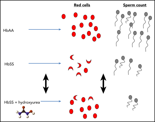 Contrasting and reversible effects of hydroxyurea on blood and sperm counts in SCA. HbAA, normal hemoglobin; HbSS, sickle cell anemia.