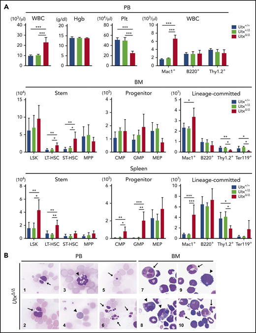 Analysis of hematopoietic parameters and morphological changes in Utx-deficient mice. (A) Analysis of hematopoietic parameters in the PB (top), BM (middle), and spleen (bottom) of Utx+/+, Utx+/Δ, and UtxΔ/Δ female mice. Hgb: hemoglobin concentration, Plt: platelet number. *P < .05; **P < .01; ***P < .001; comparison of Utx+/+, Utx+/Δ, and UtxΔ/Δ mice, assessed with a 1-way analysis of variance followed by Tukey’s test. (B) Morphological changes of hematopoietic cells in the PB (panels 1-6) and BM (panels 7-10) of UtxΔ/Δ mice. WBCs with abnormal nuclei (panels 1-3), including Pseudo Pelger-Huët anomalies (arrows) and hypersegmentation (arrowhead). A giant platelet (panel 4, arrowhead). An erythrocyte with a Howell-Jolly body (panel 5, arrow). Apoptotic cells (panel 6, arrows). Myeloid progenitor cells with abnormal nuclei and micromegakaryocytes (panels 7-10, arrows and arrowheads, respectively).
