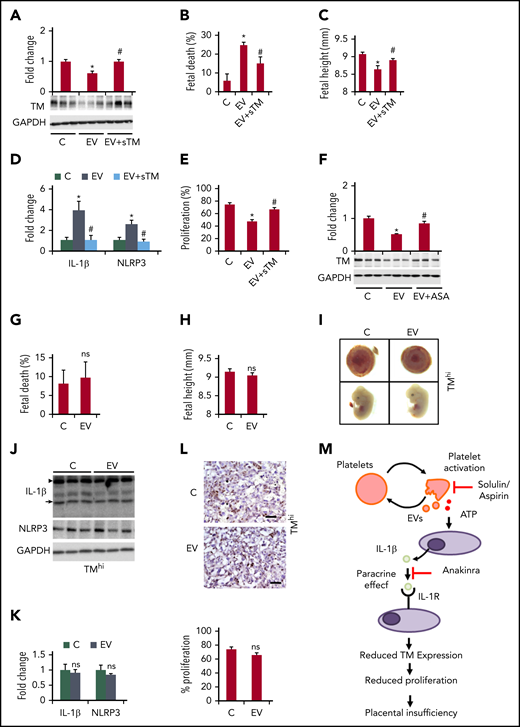 Restoring TM prevents EV-induced placental inflammasome activation and pregnancy failure. (A-E) Treatment of EV-injected pregnant C57BL/6 mice with solulin (1 mg/kg body weight) improves pregnancy outcomes. Bar graphs showing placental TM expression (A, bottom: representative immunoblots; GAPDH: loading control), fetal death (B), embryonic height (C), placental inflammasome activation, as reflected by IL-1β and NLRP3 (D, bar graph summarizing the results of immunoblot analyses), and placental cell proliferation (E, assessed by Ki-67 immunostaining, bar graph summarizing the results); n = 8 placentae from 3 different mothers; *P < .05 (relative to control, C), #P < .05 (relative to EV); ANOVA (A-E). (F) Aspirin treatment prevents the loss of placental TM expression (F, bar graph summarizing the results of immunoblot analyses; bottom, representative immunoblots; GAPDH, loading control). n = 8 placentae from 3 different mothers; *P < .05 (relative to control, C); #P < .05 (relative to EV); ANOVA. (G-L) Restoring placental TM expression prevents EV-induced pregnancy failure. Bar graphs showing fetal death (G) or embryonic height (H) and representative images showing the gross morphology of placentae (I, top) and embryos (I, bottom, n = 5 different mothers). Immunoblot images of IL-1β and NLRP3 (J, representative immunoblot; K, bar graph summarizing the results; n = 8 placentae from 3 different mothers). The arrow and arrowhead indicate the cleaved and pro forms of IL-1β, respectively. Expression of the cleaved form was quantified. Ki-67 immunostaining (L, top, representative images taken at ×40 magnification; bottom, bar graph summarizing results; n = 8 placentae from 3 different mothers). *P < .05; Student t test (G-H,K-L). (M) Proposed model summarizing results. EVs and platelet-induced inflammasome activation in trophoblast cells reduce trophoblast TM expression, reducing trophoblast proliferation and causing placental insufficiency. Note that loss of trophoblast TM expression is “downstream” of placental inflammasome activation and hence inflammasome inhibition does not rescue genetic TM deficiency. This model hence describes a unidirectional mechanism through which increased maternal platelet activation, as observed in PE, results in placental insufficiency and embryonic demise. Inhibiting this thromboinflammatory mechanism by solulin or anakinra can restore placental TM levels. ASA, acetylsalicylic acid (aspirin); ATP, adenosine triphosphate.