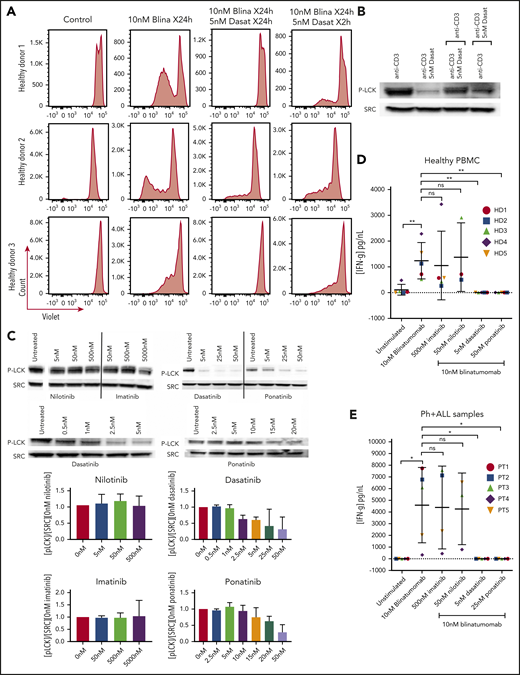 Assessment of brief exposure, cytokine release, and activation of LCK. (A) PBMC response to brief treatment of dasatinib from 3 healthy donors. Cells from healthy donors were cultured for 5 days alone or with 10 nM blinatumomab with 5 nM dasatinib for 24 hours compared with 2 hours. Cells were then assessed by multiparametric flow cytometry gated for CD45+ cells. Histograms of CD3+ cells were assessed for retention of CellTrace Violet. Loss of intensity is a marker of cell proliferation. (B) Recovery of the T-cell response after dasatinib treatment. Jurkat cells were cultured with anti-CD3 and anti-CD28, or anti-CD3 and anti-CD28 plus dasatinib for 2 hours. After 2 hours, anti-CD3–treated cells were treated with anti-CD3 plus dasatinib, and the CD3 plus dasatinib treated cells were treated with anti-CD3 only. Cell lysate was then isolated, separated, and immunoblotted for phospho-tyr 394 LCK (P-LCK) or total Src. (C) Assessment of LCK phosphorylation by treatment with ABL kinase inhibitors. Jurkat cells were stimulated at baseline with CD3 and CD28 for 4 hours without (untreated) or with nilotinib, imatinib, dasatinib, and ponatinib at the specified concentration. Cell lysate was then isolated, separated, and immunoblotted for phospho-tyr 394 LCK (P-LCK) or total Src. P-LCK blots were quantified compared with total SRC and then normalized to untreated. Histograms below the blots represent the percent inhibition with the standard deviation. (D) IFN-γ expression from PBMCs from healthy donors. Samples were either unstimulated or treated with 10 nM blinatumomab with or without 500 nM imatinib, 50 nM nilotinib, 5 nM dasatinib, or 25 nM ponatinib for 5 days. Media were then harvested and assessed for concentration of IFN-γ (IFN-γ). Comparisons were performed by Student t test (*P < .05, **P < .01). (E) IFN-γ expression from Ph+ ALL samples. Samples were either unstimulated or or treated with 10 nM blinatumomab with or without 500 nM imatinib, 50 nM nilotinib, 5 nM dasatinib or 25 nM ponatinib for 5 days. Media were then harvested and assessed for concentration of IFN-γ. Comparisons were performed bu Student t test (*P < .05, **P < .01).