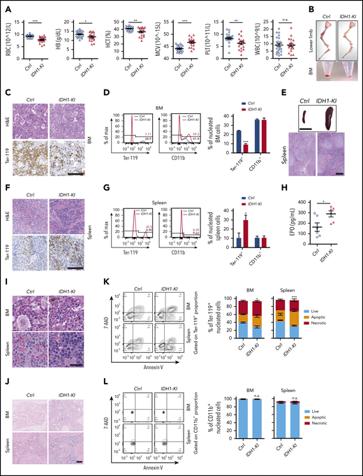 Mutant IDH1 knockin mice suffer from anemia and dyshematopoiesis. (A) Complete blood count (CBC) analysis of peripheral blood from 3- to 5-month-old control (Ctrl) (VavCre/IDH1WT/WT) and IDH1-KI (VavCre/IDH1WT/R132Q) mice (n = 24 for Ctrl; n = 18 for IDH1-KI). (B) Macroscopic views of the lower limb skeleton (top) and limb BM (bottom) cell pellets from Ctrl and IDH1-KI mice. Results are representative of 8 pairs of mice. (C) Hematoxylin and eosin (H&E) staining (top) and immunostaining (bottom) to detect the erythroid-specific marker Ter-119 in sections of BM of lower limbs from Ctrl and IDH1-KI mice in panel B (n = 5/group). Scale bar, 100 μm. (D) Left, flow cytometric analysis of percentages of Ter-119+ and CD11b+ cells in nucleated BM cells from Ctrl and IDH1-KI mice. Right, quantitation of the data in the left panels. Data are the mean ± SEM (n = 3). (E) Macroscopic views (top) and H&E staining (bottom) of spleens from control and IDH1-KI mice (n = 5/group). Scale bar, 1 cm (top) or 100 μm (bottom). (F) H&E staining (top) and Ter-119 staining (bottom) of spleens from Ctrl and IDH1-KI mice (n = 3/group). Scale bars, 100 μm. (G) Left, flow cytometric analysis of percentages of Ter-119+ and CD11b+ cells among nucleated spleen cells from Ctrl and IDH1-KI mice. Right, quantitation of the results in the left panel. Data are the mean ± SEM (n = 3/group). (H) Serum erythropoietin (EPO) level analysis by ELISA from 3- to 5-month-old Ctrl and IDH1-KI mice. Data are the mean ± SEM (n = 6/group). H&E (I) and Perls’ Prussian Blue (J) staining of BM and spleen sections from Ctrl and IDH1-KI mice (n = 3/group). Blue arrowhead in panel I, deposited pigment. Scale bar, 50 μm (I) or 100 μm (J). (K-L) Left, flow cytometric analysis of cell death as determined by7-AAD/Annexin V staining of Ter-119+ erythroblasts (K) and CD11b+ myeloid cells (L) from the BM and spleen of Ctrl and IDH1-KI mice. Right, quantitation of percentages of live, apoptotic (7-AAD–Annexin V+), and necrotic (7-AAD+Annexin V+) cells in the left panels. Data are the mean ± SEM (n = 4). *P < .05; **P < .01; ***P < .001. RBC, red blood cells; HB, hemoglobin; HCT, hematocrit; MCV, mean corpuscular volume; n.s., not significant; PLT, platelet; WBC, white blood cells.