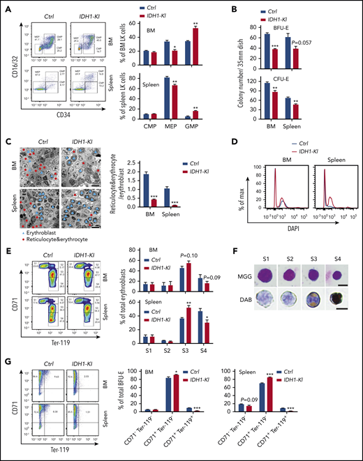 Mutant IDH1 impedes erythropoiesis in mice. (A) Left, flow cytometric determination of the proportions of CMP (CD16/32–CD34+), MEP (CD16/32–CD34–), and granulocyte-monocyte progenitors (GMP) (CD16/32+CD34+) among BM or spleen LK cells from control and IDH1-KI mice. Right, quantitation of the results in the left panel. Data are the mean ± SEM (n = 5). (B) Quantitation of numbers of colonies arising in cultures of nucleated BM or spleen cells that were isolated from control or IDH1-KI mice and cultured in BFU-E medium for 14 days or colony-forming unit-erythroid (CFU-E) medium for 2 days. Data are the mean ± SEM (n = 3). (C) Left, representative transmission electron micrographs of BM and spleen sections from control and IDH1-KI mice. Blue triangles, erythroblasts; red dots, reticulocytes and erythrocytes. Scale bars, 20 μm. Right, quantitation of the ratio of reticulocytes plus erythrocytes to erythroblasts in the left panels. Data are the mean ± SEM (n = 3). (D) Representative flow cytometric analysis of 4′,6-diamidino-2-phenylindole (DAPI) staining of Ter-119+ erythroid cells in BM and spleen of control and IDH1-KI mice (n = 3). (E) Left, flow cytometric analysis of erythroblasts in BM and spleen of control and IDH1-KI mice. Erythroblasts were divided into 4 subpopulations by surface staining for CD71 and Ter-119: Ter-119medCD71high proerythroblasts (S1), Ter-119highCD71high basophilic erythroblasts (S2), Ter-119highCD71med late basophilic and polychromatophilic erythroblasts (S3), and Ter-119highCD71low orthochromatophilic erythroblasts (S4). Right, quantitation of percentages of the S1 to S4 populations in the left panel. Data are the mean ± SEM (n = 5). (F) Representative images of erythroblasts at S1 to S4 stages (from panel E) stained with May-Grünwald-Giemsa (MGG; top) or 3,3′-diaminobenzidine (DAB)/hematoxylin (bottom) (n = 5). Scale bars, 10 μm. (G) Left, flow cytometric analysis of nucleated BM or spleen cells that were isolated from control and IDH1-KI mice, cultured in BFU-E medium for 14 days, and surface-stained to detect CD71 and Ter-119. Right, quantitation of proportions of the CD71–Ter-119–, CD71+Ter-119–, and CD71+Ter-119+ populations in the left panel. Data are the mean ± SEM of the collective results of 3 independent experiments. *P < .05; **P < .01; ***P < .001.