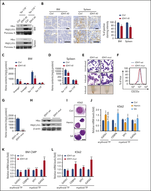 IDH1 mutation causes heme deficiency in erythroid cells. (A) Immunoblot to detect the indicated hemoglobin proteins in Ter-119+ and Ter-119– nucleated cells from BM and spleen of control and IDH1-KI mice (n = 3). Ponceau S, loading control. (B) Left, low (top) and high (insets; bottom) magnification views of 3,3′-diaminobenzidine/hematoxylin-stained sections of BM and spleen from control and IDH1-KI mice. Scale bars, 50 μm. Right, quantitation of 3,3′-diaminobenzidine staining intensities in the left panels. Data are the mean ± SEM (n = 4). (C-D) Quantitation of heme content as determined by fluorescence spectroscopy in lineage+, lineage–, Ter-119+, and Ter-119– nucleated BM cells (C) and in Ter-119+ and Ter-119– nucleated spleen cells (D) from control and IDH1-KI mice. Data are the mean ± SEM (n = 4). (E) Top and middle, representatitve May-Grünwald-Giemsa staining of K562 cells expressing WT or mutant IDH1 that were left uninduced (top) or induced with hydroxyurea plus sodium butyrate (middle). Bottom, cell pellets of the cells in the middle panel. Scale bars, 50 μm. (F) Representative flow cytometric analysis of CD235a expression by the induced K562 cells in panel E (n = 5). (G) Quantitation of heme content in the induced cells in panel E determined as in panel C (n = 5). (H) Immunoblot to detect the indicated hemoglobin proteins in the induced K562 cells in panel E (n = 3). β-actin, loading control. (I) Microscopic view of nontransfected K562 cells that were treated with either hemin or SA (heme synthesis inhibitor) and stained by using the WG-KI biochemistry method to detect peroxidase particles (n = 5). Scale bars, 10 μm. (J) Relative mRNA levels of GATA1, CEBPA, SPI1, and GATA2 in the K562 cells in panel I. Data are the mean ± SEM (n = 4). β-actin, endogenous control. (K) Relative mRNA levels of GATA1, CEBPA, SPI1, and GATA2 in BM CMPs from control and IDH1-KI mice. Data are the mean ± SEM (n = 4). β-actin, endogenous control. (L) Relative mRNA levels of GATA1, CEBPA, SPI1, and GATA2 in K562 cells overexpressing WT or mutant IDH1.Data are the mean ± SEM (n = 4). *P < .05; **P < .01; ***P < .001. β-actin, endogenous control. TF, transcription factor.