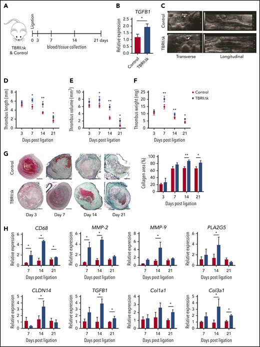 Thrombus resolution in mice with fibroblast-specific TGF-β overactivity. (A) Workflow for thrombus induction and (B) qPCR analysis for TGFB1 expression in lungs of control and TBRIIΔk mice at baseline (n = 4 mice per group). (C) Representative HFUS images showing thrombus area (left) and length (right) measurement on day 7 after ligation in control and TBRIIΔk mice. (D) Thrombus length, (E) thrombus volume as measured by HFUS (n = 5 mice per group), and (F) harvested thrombus weight (n = 5-8 mice per group). (G) Representative trichrome staining of mouse thrombus at different time points after ligation and collagen area represented relative to total thrombus area (n = 5-7 mice per group). Right: bar graph quantification for both groups is shown next to histochemistry panels (scale bars, 200 µm). (H) qPCR analysis of mouse thrombus at different time points (n = 4-6 mice per group). Data are shown as mean ± SEM. *P < .05; **P < .01 (unpaired Student t test).