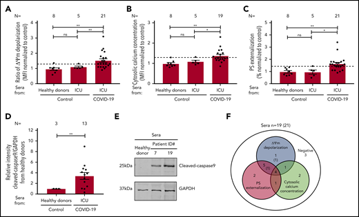 Impact of sera from COVID-19 patients on platelet apoptosis. (A-C) Changes in apoptosis pathways induced by sera from COVID-19 patients in the ICU, non–COVID-19 patients in the ICU (control group), and healthy donors were investigated by assessing the depolarization of the ΔΨm (A), cytosolic calcium concentration (B) (n = 19 because of the lack of biomaterial for 2 patients), and PS externalization (C). (D) Quantification of cleaved caspase 9 level in platelets from healthy donors after incubation with patient sera, normalized to sera from healthy donors. (E) Representative western blot of GAPDH and cleaved caspase 9 proteins. Protein bands were detected with the infrared imaging system (Odyssey, LI.COR). (F) Diagram indicating the number of COVID-19 patients in the ICU positive for each apoptotic parameter: ΔΨm depolarization, cytosolic calcium concentration, and PS externalization. The 2 sera tested only for ΔΨm depolarization and PS externalization are in parentheses. Data are presented as mean ± SEM of the measured FI compared with control. Not significant, *P < .05, **P < .01, ***P < .001, ****P < .0001. The number of sera tested is reported in each graphic. Dashed lines represent the cutoffs determined testing sera from healthy donors as mean of FI + 2× SEM.