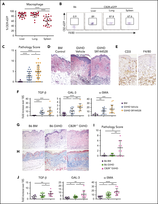 Signaling through the CB2R regulates the severity of chronic GVHD. (A-B) The eGFP expression percentage on macrophages derived from the liver, lung, or spleen of normal CB2ReGFP mice (n = 20-23) is shown. Representative dot plots showing eGFP expression on macrophages from these tissue sites is shown in panel B. (C-D) Lethally irradiated Balb/c mice received transplants of B10.D2 BM alone (n = 9) or together with 15 × 106 B10.D2 spleen cells. Animals that received spleen cells were treated with the CB2R antagonist SR144528 (3 mg/kg; n = 24) or a vehicle control (n = 22) for 14 days beginning on the day of transplantation. Cumulative pathological chronic GVHD skin scores of mice 30 to 40 days posttransplantation are depicted in panel C. Representative hematoxylin and eosin–stained sections of the skin on day 35 are shown in panel D. Original magnification is ×100 for photomicrographs. Data are derived from 5 experiments. (E) Immunohistochemical staining depicting CD3 and F4/80 positive cells (brown coloration) in the skin of mice treated with SR144528. (F) mRNA expression of transforming growth factor β (TGF-β), galectin 3 (GAL-3), and α smooth muscle (α-SMA) in the skin of animals 30 to 40 days posttransplantation. Results are from 3 experiments, with 6 to 15 mice per group. (G-J) Lethally irradiated (850 cGy) Balb/c mice received transplants of B6 Rag-1−/− BM alone, B6 Rag-1−/− BM and B6 spleen cells (adjusted to yield an αβ T-cell dose of 0.4 × 106), or CB2R−/− BM and spleen cells (adjusted to yield the same αβ T-cell dose). Representative hematoxylin and eosin– and trichrome-stained sections of the skin on day 45 are shown in panels G and H, respectively. Original magnification is ×100 for photomicrographs. (I) Pathology scores of the skin 40 to 45 days posttransplantation in chronic GVHD mice. Results are from 3 experiments, with 7 to 13 mice per group. (J) mRNA expression of TGF-β, GAL-3, and α-SMA in the skin of animals (n = 8-15 mice per group) 40 to 45 days posttransplantation. Results are from 3 experiments. Data in panels in A, C, F, I, and J are presented as the mean ± standard deviation. *P < .05, **P < .01, ***P < .001, ****P < .0001.