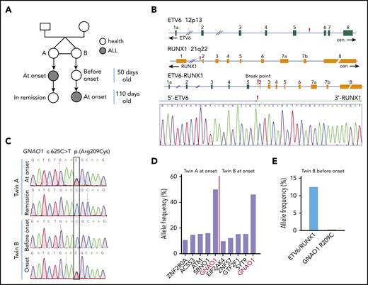 Mutational analysis in a monozygotic twin pair identified the GNAO1 R209C mutation as a second hit for ETV6-RUNX1+ preleukemia. (A) Schematics of a pair of monozygotic twins who were diagnosed with leukemia within 110 days after birth. (B) Schematics of the t(12; 21) ETV6-RUNX1 fusion gene and validation by PCR sequencing. (C) Sanger sequencing of the twins’ samples. GNAO1 c.625C>T point mutations in the twins’ samples at onset of leukemia are indicated: twin A, at the onset of leukemia and at remission; twin B, before the onset of leukemia and at the onset of leukemia. (D) Allele frequency analysis of gene mutations by deep genomic sequencing in the onset specimens from the twins, corresponding to supplemental Table 1. (E) Allele frequency analysis of the ETV6-RUNX1 fusion gene and GNAO1 R209C mutation in twin B before the onset of leukemia.