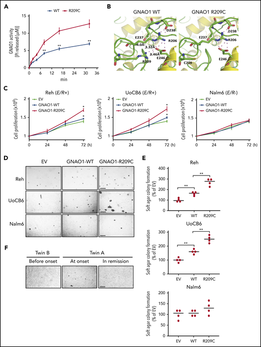 GNAO1 R209C mutation increases its enzymatic activity and promotes cell proliferation and neoplastic transformation. (A) Enzymatic activity analysis of WT GNAO1 and the R209C mutant. A GTPase activity analysis was performed with the GTPase colorimetric assay kit. (B) The simulated crystal structures of WT GNAO1 and the R209C mutant. (C) Effects of ectopic expression of WT GNAO1 or the R209C mutation on cell proliferation in Reh, UoCB6, and Nalm6 cells. Cell proliferation analysis was performed using the Click-iT EdU Assay Kit. (D) Representative images of soft agar colony formation. Scale bar, 1 mm. (E) Quantification of soft agar colony formation in panel D. (F) Representative images of soft agar colony formation of the PBMC specimens from twin B before the onset of leukemia, twin A at the onset of leukemia, or twin A at remission. Data are representative of 3 or 4 independent experiments with similar results. Scale bar, 1 mm. (A,C,E) data are expressed as the mean ± SD. *P < .05; **P < .01, by 2-tailed Student t test.