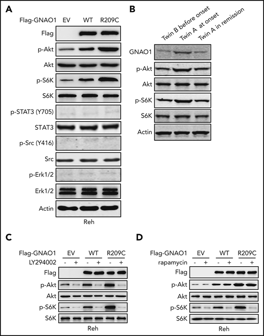 GNAO1 R209C mutation activates PI3K/Akt/mTOR signaling. (A) Western blot (WB) analysis of phosphorylation of Akt (p-Akt), STAT-3 (p-STAT3), Src (p-STAT3), and Erk1/2 (p-Erk1/2) in Reh cells with ectopic expression of Flag-tagged WT GNAO1, the R209C mutant, or an empty vector (EV) control. (B) WB of GNAO1, p-Akt, and p-Erk1/2 in the PBMC samples from twin B before onset, twin A at onset, and twin A at remission. (C) Effects of treatment with PI3K inhibitor LY294002 on p-Akt and p-S6K stimulation in Reh cells expressing WT GNAO1, the R209C mutant, or an EV control. Cells were treated with LY294002 (10 μM) for 1 hour. (D) Effects of treatment with the mTORC1 inhibitor rapamycin on p-Akt and p-S6K stimulation. Cells were treated with rapamycin (250 nM) for 1 hour. Data are representative of 3 independent experiments with similar results.