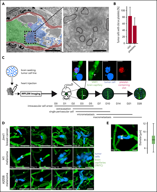 Ultrastructural and intravital imaging of clot components during BM. (A) EM images of intravascularly arrested Jimt1 (breast cancer) TCs (green) associated with a clot (blue) and platelet aggregates (purple). The vessel wall is depicted in red. Platelets (dotted outlines in high-magnification images) are embedded in the clot. Scale bars in colorized overview panels, 5 µm; scale bars in high-magnification panels: 1 µm. (B) Quantification of arrested TCs on days 5 to 7 p.i.i. with associated (platelet) clot in EM imaging (32 metastatic Jimt1 breast cancer cells from 9 mice). Error bars: 95% CI. (C) Experimental design for studying the impact of the coagulation system on the steps of BM formation in mice. TCs are injected intracardially and followed immediately by in vivo MPLSM through a chronic cranial window. The superior sagittal sinus (white arrow) serves as an anatomical orientation. Microscopy images of the same brain regions over 1 month are used to follow single arrested TCs as they process through the brain metastatic cascade: initial intravascular cell arrest (days 0-5), early extravasation between days 2 and 7, single cell in the perivascular niche (days 2-10), followed by outgrowth into a micrometastasis (3-50 cells) and finally macrometastasis (>50 cells) on day 28. Magnification micrograph: coregistration of circulating platelets (red) and FITC-labeled anti-VWF antibody (green) bound to the typically large VWF fibers (arrowhead) on day 7 p.i.i. next to an intra- and extravascular TC (blue). Scale bars, 10 µm. (D) Representative in vivo MPLSM images over time of the distinct steps of the brain metastatic cascade of all 3 cell line models, which were investigated with MPLSM (without clot imaging). At persistent cell arrest, TCs fill out the whole lumen of the brain capillary with a cell-vessel diameter ratio of 1 (H-bars). Distinct deep vessels are given as reference points (white asterisks) for orientation. Vascular remodeling occurs around distinct arrested/extravasating TCs. Scale bars, 50 µm. (E) Mean diameter of brain capillaries where TCs arrest. Diameter was measured as indicated (H-bar) where intravascularly arrested TCs were in vicinity (105 cells in 6 mice; boxplot; median, 8 µm). Scale bar, 10 µm. TRITC, tetramethylrhodamine-isothiocyanate.