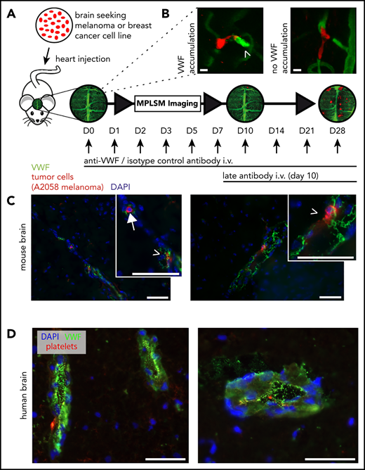 Interaction of melanoma and breast cancer brain seeding TCs with VWF. (A) Experimental design of in vivo MPLSM imaging in anti-VWF–treated mice vs isotype control antibody–treated mice. Treatment was started 30 minutes before TC injection, then given once per day, and then following the imaging schedule after day 3. Late antibody treatment started on day 10. Individual arrested TCs were followed throughout the brain metastatic cascade until day 28 after TC injection. (B) Representative images of intravital VWF immunofluorescence staining with anti-VWF antibody on day 3 after TC injection. It was obligatory to evaluate a clear green fluorescence signal accumulation (arrowhead) as positive VWF activation (VWF relative fluorescence intensity ∼1.5×; semi-quantitative analysis). Faint background vessel signal represents unbound FITC-labeled antibody, creating an angiogram. Scale bars: 10 µm. (C) Mouse brain slides. Representative images with immunofluorescent staining of an arrested intravascular A2058 melanoma cell (arrow) and possibly extravasating TCs (arrow heads) and their interaction with VWF fibers (green). 4,6 Diamidino-2-phenylindole (DAPI) staining in blue. Scale bars: 50 µm. (D) Human brain slides. Images with immunofluorescent staining of human perimetastatic brain tissue around a breast cancer brain metastasis. Abundant VWF fibers (green) are detectable in associated vessels and endothelial cells. DAPI staining (blue) and platelet staining (red). Scale bars: 50 µm.