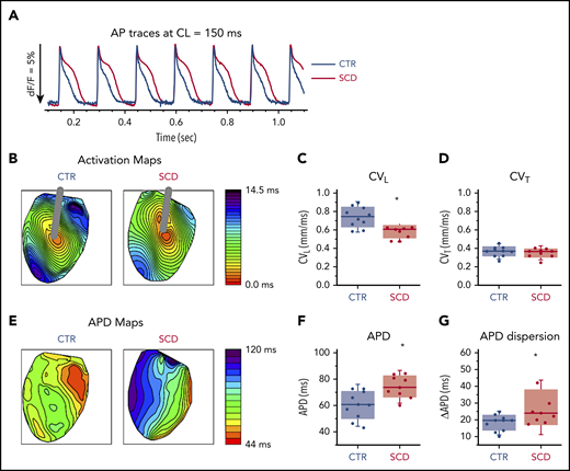Prolongation of APD and slow conduction in hearts of SCD mice. (A) Representative AP traces from CTR (black) and SCD (red) hearts. (B) Activation maps from CTR (left) and SCD hearts (right). The center of the LV was stimulated with a concentric bipolar electrode to measure longitudinal conduction velocity (CVL) and transverse conduction velocity (CVT). (C-D) CVL of SCD hearts was slower than that for CTR hearts (0.75 ± 0.11 ms in CTR vs 0.58 ± 0.07 ms in SCD mice; P = .002), and CVT was not significantly different between CTR and SCD hearts (0.37 ± 0.056 ms in CTR vs 0.35 ± 0.05 ms in SCD mice; P = .51). *P < .05. Error bars represent standard error. (E) APD maps from the LV in CTR and SCD hearts. (F) APDs of SCD hearts were prolonged (60.4 ± 10.7 ms in CTR vs 74.5 ± 8.4 ms in SCD; P = .006). (G) Spatial dispersion of APDs was also increased in SCD hearts (18.3 ± 4.8 ms in CTR vs 27.6 ± 10.9 ms in SCD; P = .025) (n = 10 for CTR group; n = 9 for SCD group). Median values displayed with whiskers using the Tukey method. CL, cycle length.