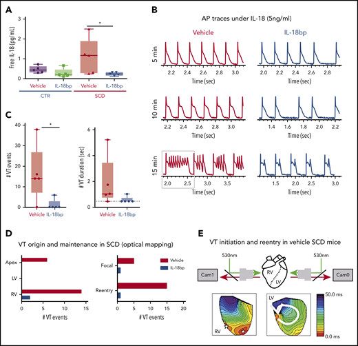 IL-18BP treatment prevents VT initiations under IL-18 exposure in murine SCD hearts. (A) Free IL-18 levels were higher in SCD mice compared with CTR mice, both with exposure to vehicle for 4 weeks, and reduced with IL-18BP exposure for 4 weeks in SCD mice compared with vehicle administration (CTR + vehicle, 0.46 ± 0.07 pg/mL; CTR + IL-18BP, 0.28 ± 0.09 pg/mL; SCD + vehicle, 1.13 ± 0.35 pg/mL; SCD + IL-18BP, 0.24 ± 0.03 pg/mL; ANOVA P = .026; n = 5 for each group). (B) Representative AP and VT traces under IL-18 in vehicle and IL-18BP treated hearts in the presence of 5 ng/mL IL-18. PVCs and VT were frequently induced in vehicle-treated hearts (n = 4 of 5) compared with IL-18BP-treated hearts (n = 1 of 5). (C) IL-18BP treatment suppressed incidence of VT events and VT duration. (D) Focal activity from RV and reentry formations were markedly reduced in the IL-18BP group. (E) Activation maps from the RV and LV showed that focal activity from the RV formed reentry to initiate a transient VT shown in panel B (gray box represents the VT episode that was used for activation maps shown in panel E). Median values displayed with whiskers using the Tukey method. *P < .05. Horizontal bar in panels A and C signify mean of values. Error bars represent standard error. Cam0, camera 0; Cam1, camera 1.