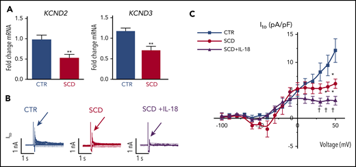 IL-18 effects on Ito in murine SCD hearts. (A) KCND2 and KCND3 gene expression levels were lower in SCD mice compared with CTR mice (n = 5 mice for both groups). (B) Representative Ito traces from CTR and SCD myocytes. (C) Current-voltage curve of Ito shows that the SCD heart has lower Ito amplitude above 0 mV, which is further reduced by IL-18 (25 ng/mL) (n = 5 mice for CTR group; n = 6 mice for SCD group). *P < .05; **P < .01 compared with CTR group. †P < .05, compared with SCD group. Error bars in panels A and C represent standard error. nA, nanoampere; pA, picoampere; pF, picofarad.