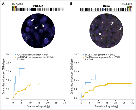 PDL1/2 or BCL6 chromosome maps and cumulative risk of CNS relapse by PDL or BCL6 rearrangement. The maps display relative probe positions for break-apart assays, and representative rearrangement-positive cases are depicted, with arrows denoting nuclei. Images were obtained with an Olympus BX61 microscope, original magnification ×40, at room temperature, with ARIOL software, v3.4; (Genetix). The cumulative risk of CNS relapse (using competing risk analysis) among cases with or without a PDL1- or -2 (A) or a BCL6 (B) rearrangement, as determined by FISH.