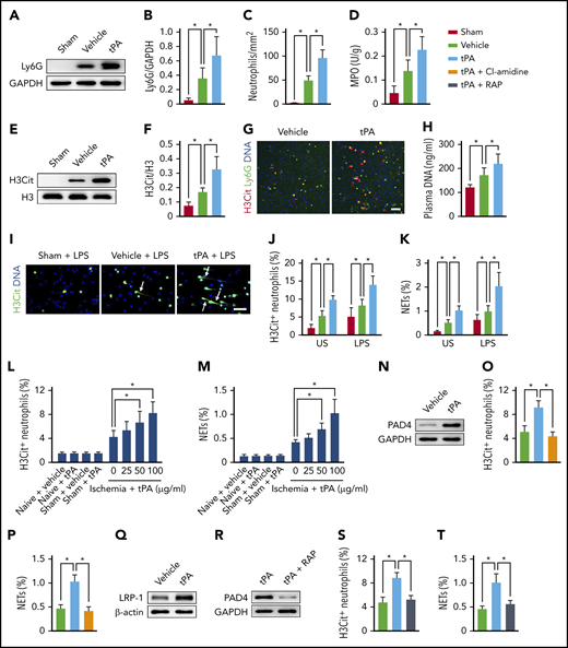 tPA activates neutrophils to release NETs after ischemic stroke. (A-B) Representative immunoblots and quantitative determinations of the amount of neutrophils in the ischemic cortex at 24 hours after stroke in mice treated with vehicle or tPA compared with mice undergoing sham surgery (n = 5). (C) Quantification of the numbers of infiltrating neutrophils in the ischemic cortex at 24 hours after stroke (n = 6). (D) Quantification of MPO activity in the ischemic brain (n = 6). (E-F) Representative immunoblots and quantitative determinations of H3Cit levels in the ischemic cortex (n = 5). (G) Representative confocal images of H3Cit+ neutrophils in the peri-infarct cortex. Scale bar, 50 μm. (H) Quantification of plasma DNA (n = 6). (I) Representative images of isolated peripheral blood neutrophils from mice undergoing sham surgery and ischemic mice treated with vehicle or tPA. Neutrophils were incubated with LPS for 2.5 hours. DNA was stained with Hoechst 33342 (blue), and neutrophils were stained with H3Cit (green). Arrows indicate NETs. Scale bar, 50 μm. (J-K) Quantification of the percentage of H3Cit+ neutrophils and NETs in unstimulated (US) and LPS-stimulated peripheral blood neutrophils (n = 8). (L-M) Quantification of the percentage of H3Cit+ neutrophils and NETs in peripheral blood neutrophils isolated from naïve mice, mice undergoing sham surgery, or ischemic mice (n = 5-8). Neutrophils from naive mice or mice undergoing sham surgery were treated with vehicle or 100 μg/mL of tPA. Neutrophils from ischemic mice were treated with vehicle or 25, 50, or 100 μg/mL of tPA. (N) Representative immunoblots of PAD4 expression in neutrophils isolated from ischemic mice. Neutrophils were treated with vehicle or 100 μg/mL of tPA. (O-P) Quantification of the percentage of H3Cit+ neutrophils and NETs in neutrophils isolated from ischemic mice (n = 8). Neutrophils were treated with vehicle, 100 μg/mL of tPA, or tPA in combination with the PAD inhibitor Cl-amidine. (Q) Representative immunoblots of lipoprotein receptor–related protein 1 (LRP-1) expression in neutrophils isolated from ischemic mice. Neutrophils were treated with vehicle or 100 μg/mL of tPA. (R) Representative immunoblots of PAD4 expression in neutrophils isolated from ischemic mice. Neutrophils were treated with 100 μg/mL of tPA or tPA in combination with the LRP antagonist RAP. (S-T) Quantification of the percentage of H3Cit+ neutrophils and NETs in neutrophils isolated from ischemic mice (n = 8). Neutrophils were treated with vehicle, 100 μg/mL of tPA, or tPA in combination with the LRP antagonist RAP. Values are means ± standard deviation. *P < .05. GAPDH, glyceraldehyde-3-phosphate dehydrogenase.