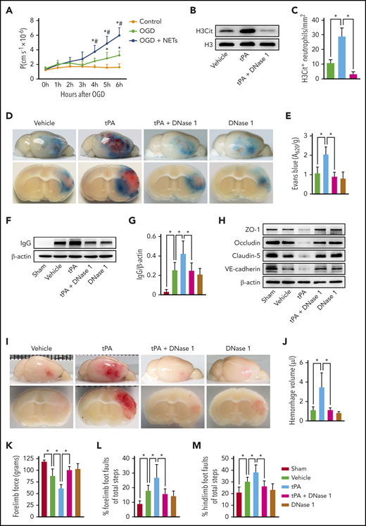 DNase I treatment reduces tPA-mediated BBB breakdown and cerebral hemorrhage after ischemic stroke. (A) Permeability coefficient (P) of human brain endothelial monolayers to 40 KDa of FITC-dextran at 0 to 6 hours after normoxia or OGD with or without NETs (1.5 μg/mL). (B) Representative immunoblots of H3Cit levels in the ischemic cortex at 24 hours after stroke in mice treated with vehicle, tPA, or tPA in combination with DNase I. (C) Quantification of the numbers of H3Cit+ neutrophils in the ischemic cortex (n = 6). (D) Representative images of the dorsal surface (upper panel) and a coronal section (bottom panel) show Evans blue extravasation 24 hours after stroke in mice treated with vehicle, tPA, tPA in combination with DNase I, or DNase I alone. (E) Quantification of Evans blue fluorescence intensity for each group (n = 8). (F-G) Representative immunoblots and quantification of immunoglobulin G (IgG) levels in capillary-depleted brain tissue at 24 hours after stroke (n = 5). (H) Representative immunoblots of the tight junction proteins zonula occludens-1 (ZO-1), claudin-5, and occludin and the adherens junction protein vascular endothelial–cadherin (VE-cadherin) in isolated brain microvessels. (I) Representative images of the dorsal surface (upper panel) and a coronal section (bottom panel) show cerebral hemorrhage 24 hours after stroke in mice treated with vehicle, tPA, tPA in combination with DNase I, or DNase I alone. (J) Quantification of cerebral hemorrhage by spectrophotometric hemoglobin assay (n = 8). (K-M) DNase I treatment improved neurological functions in forelimb force test and beam walking test (n = 10). Values are means ± standard deviation. *P < .05 vs control group (A), #P < .05 vs OGD group (A), *P < .05 (C,E,G,J-M).