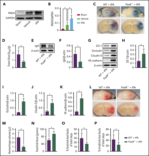NETs and PAD4 contribute to tPA-mediated BBB disruption and cerebral hemorrhage after ischemic stroke. (A-B) Representative immunoblots and quantification of PAD4 levels in the ischemic cortex 24 hours after stroke in mice treated with vehicle or tPA compared with mice undergoing sham surgery (n = 5). (C) Representative images of the dorsal surface (upper panel) and a coronal section (bottom panel) show Evans blue extravasation 24 hours after stroke in WT and Pad4−/− mice treated with tPA. (D) Quantification of Evans blue fluorescence intensity for each group (n = 8). (E-F) Representative immunoblots and quantification of IgG levels in capillary-depleted brain tissue at 24 hours (n = 5). (G-K) Representative immunoblots and quantification of zonula occludens-1 (ZO-1), occludin, claudin-5, and vascular endothelial–cadherin (VE-cadherin) in isolated brain microvessels (n = 5). (L) Representative images of the dorsal surface (upper panel) and a coronal section (bottom panel) show cerebral hemorrhage 24 hours after stroke in WT and Pad4−/− mice treated with tPA. (M) Quantification of cerebral hemorrhage by spectrophotometric hemoglobin assay (n = 8). (N-P) Effects of PAD deficiency on forelimb force test and beam walking test 24 hours after stroke (n = 10). Values are means ± standard deviation. *P < .05. GAPDH, glyceraldehyde-3-phosphate dehydrogenase.