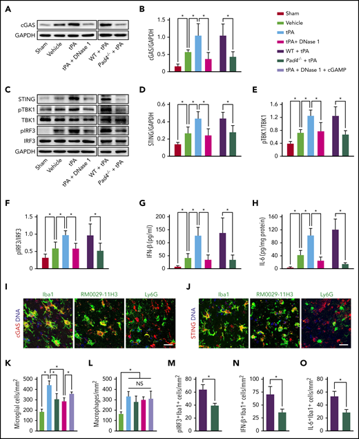 DNase I treatment or PAD4 deficiency inhibits tPA-induced upregulation of cGAS-STING and type 1 IFN signaling. (A-B) Representative immunoblots and quantification of cGAS expression in the ischemic cortex 24 hours after stroke in WT mice treated with vehicle, tPA, or tPA in combination with DNase I and in WT and Pad4−/− mice treated with tPA compared with mice undergoing sham surgery (n = 5). (C) Representative immunoblots for STING, phosphorylated (pTBK1) and total TBK1, and pIRF3 and total IRF3 expression in the ischemic cortex. (D-F) Quantification of band intensities for each group (n = 5). (G-H) Quantification of IFN-β and IL-6 levels by enzyme-linked immunosorbent assay in the ischemic cortex (n = 6). (I-J) Double immunostaining of cGAS and STING with microglial cells (Iba1), macrophages (RM0029-11H3), and neutrophils (Ly6G) in mice subjected to MCAO and tPA treatment. Scale bar, 20 μm. (K-L) Quantification of activated microglia and macrophage infiltration in the ischemic cortex (n = 6). (M-O) Quantification of the numbers of pIRF3+, IFN-β+, and IL-6+ microglial cells (Iba1) in the ischemic cortex (n = 6). Values are means ± standard deviation. *P < .05. GAPDH, glyceraldehyde-3-phosphate dehydrogenase; NS, not significant.