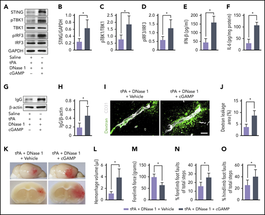 DNase I–mediated cerebrovascular protection and antihemorrhagic effects after ischemic stroke are abolished by cGAMP. (A) Representative immunoblots for STING, pTBK1 and total TBK1, and pIRF3 and total IRF3 expression in the ischemic cortex of tPA-treated mice after treatment with DNase I or DNase I in combination with cGAMP. (B-D) Quantification of band intensities for each group (n = 5). (E-F) Quantification of IFN-β and IL-6 levels by enzyme-linked immunosorbent assay in the ischemic cortex (n = 6). (G-H) Representative immunoblots and quantification of IgG levels in capillary-depleted brain tissue. (I-J) Quantification of extravascular dextran fluorescence in tPA-treated mice after treatment with DNase I or DNase I in combination with cGAMP. Scale bar, 20 μm. At 24 hours after stroke, mice were administered an intravascular injection of 40 KDa of FITC-labeled dextran, and brain sections were stained with CD31. (K) Representative images of the dorsal surface (upper panel) and a coronal section (bottom panel) show cerebral hemorrhage 24 hours after stroke. (L) Quantification of cerebral hemorrhage (n = 8). (M-O) Effects of DNase I or combination of DNase I and cGAMP on forelimb force test and beam walking test 24 hours after stroke in tPA-treated mice (n = 10). Values are means ± standard deviation. *P < .05. GAPDH, glyceraldehyde-3-phosphate dehydrogenase.