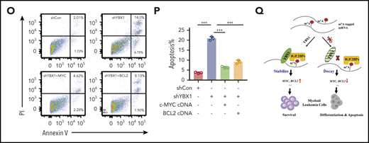 MYC and BCL2 mediate the function of YBX1 in leukemia cells. (A-C) Gene set enrichment analysis plots showing enrichment of MYC targets and genes for oxidative phosphorylation in YBX1high vs YBX1low groups from GSE14468 and TCGA AML patient cohorts. (D) Immunoblot for Myc and Bcl2 expression in WT and Ybx1cKO leukemia cells (Gapdh was used as a loading control). (E-F) Immunoblot for MYC and BCL2 expression in MOLM-13 cells (E) and THP-1 cells (F) 4 days after transduction with the indicated lentiviruses (GAPDH was used as a loading control). (G) The mRNA half-life of Myc and Bcl2 in WT and Ybx1cKO leukemia cells. (H) IGV tracks that show the distribution of m6A peaks for Myc and Bcl2 transcripts. (I) MeRIP-qPCR analysis of m6A enrichment of Myc and Bcl2 in LICs. Primers 1, 2, and 3 are located around m6A sites. (J) YBX1 RIP-qPCR analysis showing YBX1 binding to MYC and BCL2 mRNA in shControl or shIGF2BP1 leukemia cells. (K) Colony formation assay of LICs from WT and Ybx1cKO AML mice. Ybx1cKO LICs were transduced with lentiviruses expressing Myc or Bcl2. (L) Representative images from a colony formation assay indicating lentiviruses. Original magnification, ×100. (M-N) Growth curve (M) and colony formation assay (N) of MOLM-13 cells after transduction with indicated lentiviruses. (O) Flow cytometry analysis of apoptosis after transduction with indicated lentiviruses at day 4. (P) Percentages of apoptotic leukemia cells after transduction at day 4. (Q) Working model showing the role of YBX1 in leukemia. Panels D-G and I-P show 1 representative of at least 3 independent experiments. Two-tailed Student t test: *P < .05; **P < .01; ***P < .001. FDR, false discovery rate; NES, normalized enrichment score.
