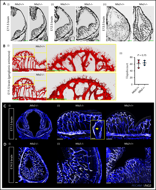 Cerebral vasculature development and pericyte recruitment is not disrupted in Nfe2−/− mice. (A) Coronal brain sections stained with PECAM-1 from E11.5 to E13.5 embryos reveal the stages of blood vessel development in Nfe2+/+ and Nfe2−/− mice (n = 3 embryos per genotype per stage; scale bars, 100 μm). (B) Identification (i) and quantification (ii) and of tip cell filipodia in the ganglion eminence of Nfe2+/+ and Nfe2−/− mice (n = 3 per genotype). Horizontal bar = mean; error = SD (ii). Scale bars, 50 μm). Data are represented as mean ± SD, and analyzed using Student t test (2-way, unpaired). (C) Pericyte (NG2, white) coverage of the E11.5 cerebral vasculature (PECAM-1, blue) in the head (scale bars, 100 μm) (i) and the ganglionic eminence (scale bars, 50 μm) (n = 3 per genotype) (ii). Inset, optical section of a pericyte in close association with a vessel. (D) Pericyte (NG2, white) coverage of the E14.5 cerebral vasculature (PECAM-1, blue) in the head (scale bars, 100 μm) (i) and ganglionic eminence (scale bars, 50 μm) (ii) (n = 3 per genotype).