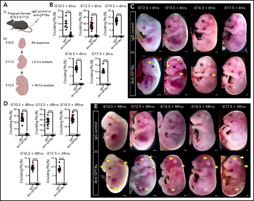 Timed induction of in utero thrombocytopenia. (A) Experimental scheme: mice were injected with anti-GP1Bα or IgG control antibodies between E10.5 and E17.5 and analyzed at 6 hours and 48 hours after injection for platelet numbers and hemorrhage phenotypes. (B) Quantification of circulating platelets as a percentage of peripheral blood at 6 hours after injection at E10.5 to E17.5. (C) Images of embryos 6 hours after treatment (E12.5: IgG n = 12, GP1Bα n = 15; E14.5: IgG n = 18, GP1Bα n = 17; E16.5: IgG n = 14, GP1Bα n = 12; E17.5: IgG n = 16, GP1Bα n = 8). Scale bars, 1 mm. (D) Circulating platelets 48 hours posttreatment. (E) E10.5 to E16.5 embryos 48 hours and E17.5 embryos 24 hours posttreatment (E10.5: IgG n = 16, GP1Bα n = 8; E12.5: IgG n = 12, GP1Bα n = 17; E14.5: IgG n = 17, GP1Bα n = 16; E16.5: IgG n = 18, GP1Bα n = 14; E17.5: IgG n = 17, GP1Bα n = 14). Scale bars, 1 mm. (B,D) Data are represented as mean 6 SD and analyzed using the Student t test (2-way, unpaired). **** P < .0001. Ab, antibody. Yellow arrows indicate sites of hemorrhage.