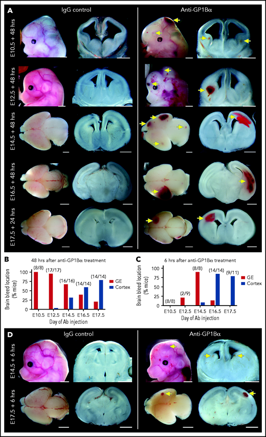 Identification of a spatial pattern of ICH. (A) Representative images of E10.5 to E17.5 heads and brains 48 hours after treatment with anti-GP1Bα or IgG (scale bars, 1 mm). (B) Frequency of hemorrhage in the ganglionic eminence (GE) and the cortex of treated E10.5 to E17.5 mice after 48 hours (E10.5: IgG n = 16, GP1Bα n = 8; E12.5: IgG n = 12, GP1Bα n = 17; E14.5: IgG n = 17, GP1Bα n = 16; E16.5: IgG n = 18, GP1Bα n = 14; E17.5: IgG n = 17, GP1Bα n = 14). Total number of mice with ICH is provided in parentheses. (C) Frequency of hemorrhage in the GE and the cortex of treated E10.5 to E17.5 mice after 6 hours (E10.5: IgG n = 8, GP1Bα n = 8; E12.5: IgG n = 9, GP1Bα n = 8; E14.5: IgG n = 7, GP1Bα n = 8; E16.5: IgG n = 7, GP1Bα n = 14; E17.5: IgG n = 6, GP1Bα n = 11). Total number of mice with ICH is provided in parentheses. (D) Representative images of hemorrhage in E14.5 (IgG n = 6, GP1Bα n = 7) and E17.5 (IgG n = 4, GP1Bα n = 6) embryos 6 hours posttreatment (scale bars, 1 mm). Yellow arrows indicate sites of hemorrhage.