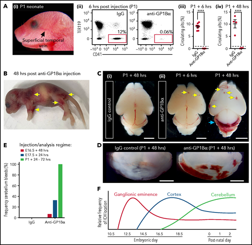 Induction of thrombocytopenia in neonates results in cerebellar hemorrhage. (A) (i) Image highlighting the facial vein of a P1 mouse used to deliver anti-GP1bα and IgG control antibodies. (ii) Representative flow cytometry plots of P1 peripheral blood stained with markers of erythrocytes (TER119) and platelets (CD41). (iii) Quantification of circulating platelets at 6 hours (IgG n = 8, GP1Bα n = 8) and 48 hours (IgG n = 4, GP1Bα n = 4) posttreatment. (B) Representative image of a P1 neonate 48 hours after treatment with anti-GP1bα (n = 7 embryos). Yellow arrows indicate sites of hemorrhage. (C) (i-iii) Representative images of brains 6 hours (IgG n = 8, GP1Bα n = 8) and 48 hours (IgG n = 4, GP1Bα n = 4) posttreatment. Yellow arrows indicate sites of cortical hemorrhage; the blue arrow highlights cerebellar hemorrhage (scale bars, 1 mm). (D) Coronal sections of cerebellum 48 hours posttreatment (bars, 1 mm). (E) Frequency of cerebellar hemorrhage in mice treated at E16.5 (IgG n = 10, GP1Bα n = 16), E17.5 (IgG n = 10, GP1Bα n = 12), or P1 (IgG n = 4, GP1Bα n = 7). (F) Summary of changes in ICH location during embryogenesis. ICHs in the ganglionic eminence, cortex, and cerebellum occur sequentially during development in a thrombocytopenic context.