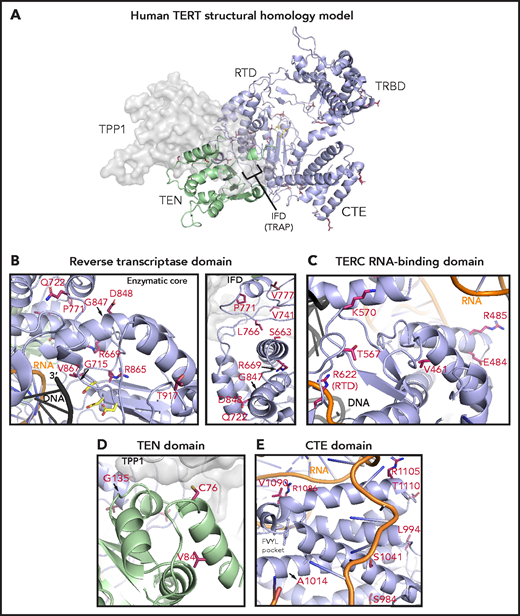 Structural analysis of TERT rare variants. (A) Human TERT homology model. The ring, formed by the TRBD, RTD, and CTE domain, is colored in purple and the TEN domain in green. Panels B, C, D, and E show the TERT rare variants within the RTD (enzymatic core and IFD regions), TRBD, TEN, and CTE domains (including the FVYL pocket), respectively. R622 belongs to the RTD but is displayed in panel C because of its proximity to the TRBD. The side-chains for the residues mutated in the MDS rare variants (crimson carbon atoms) and the catalytic residues in the active site (yellow carbon atoms) are shown in stick representation. The modeled regions of TERC are in orange, whereas the DNA substrate is depicted in black.